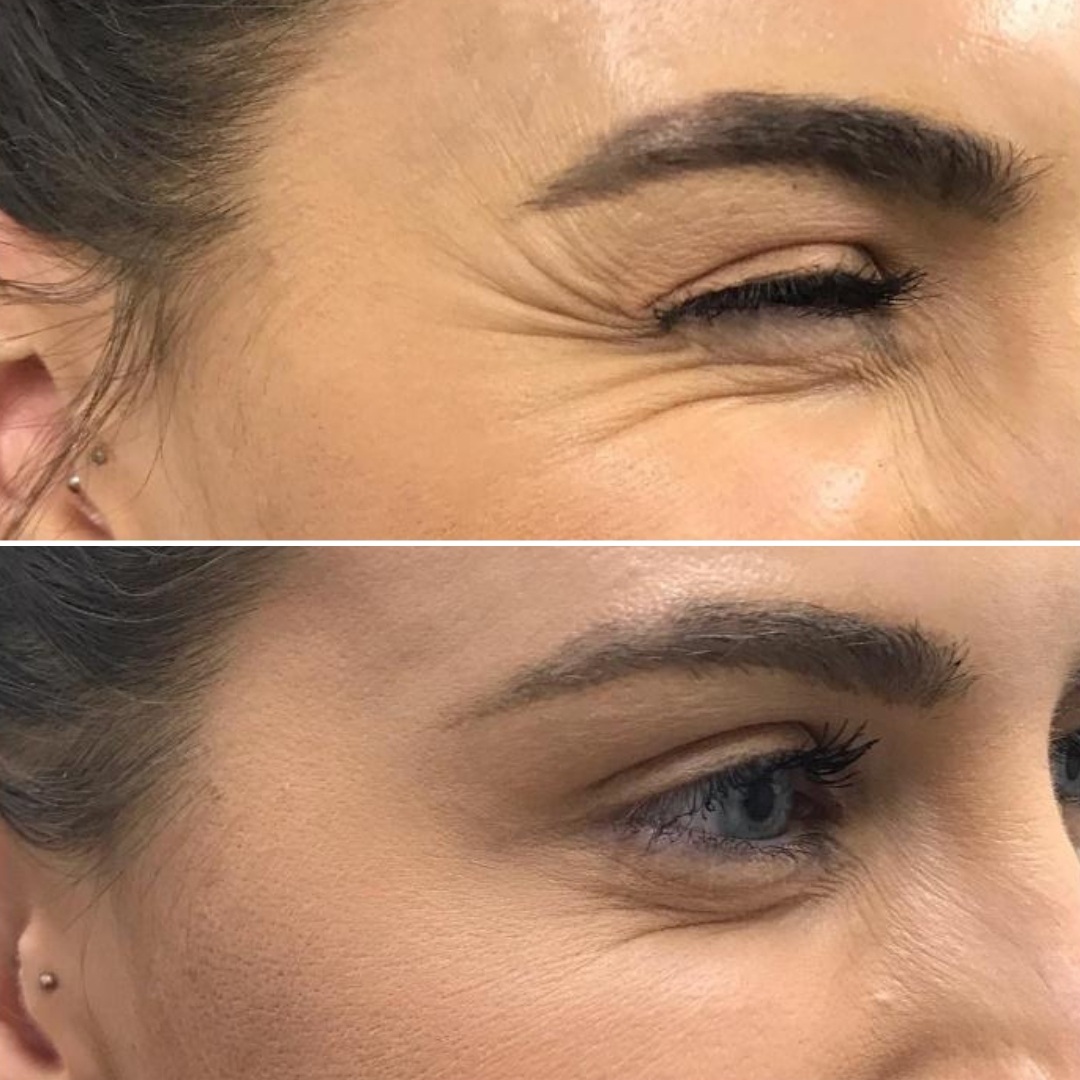 Hydra Glow Express - Serum Acide Hyaluronique - Hyaluro Filler