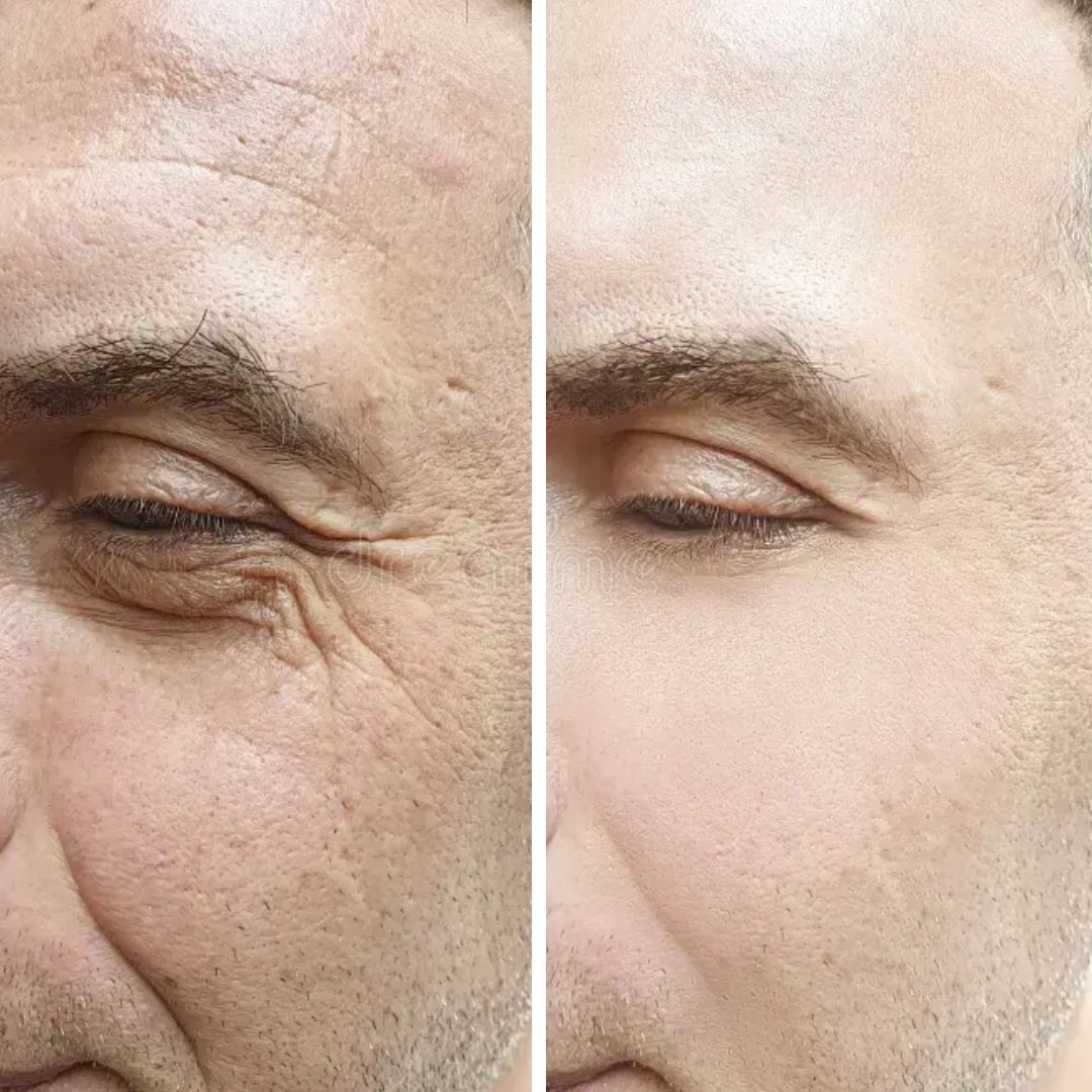 Routine Anti-âge