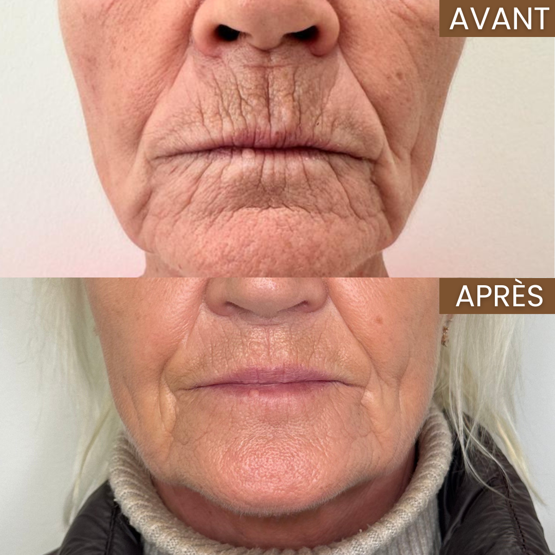 Routine Anti-âge