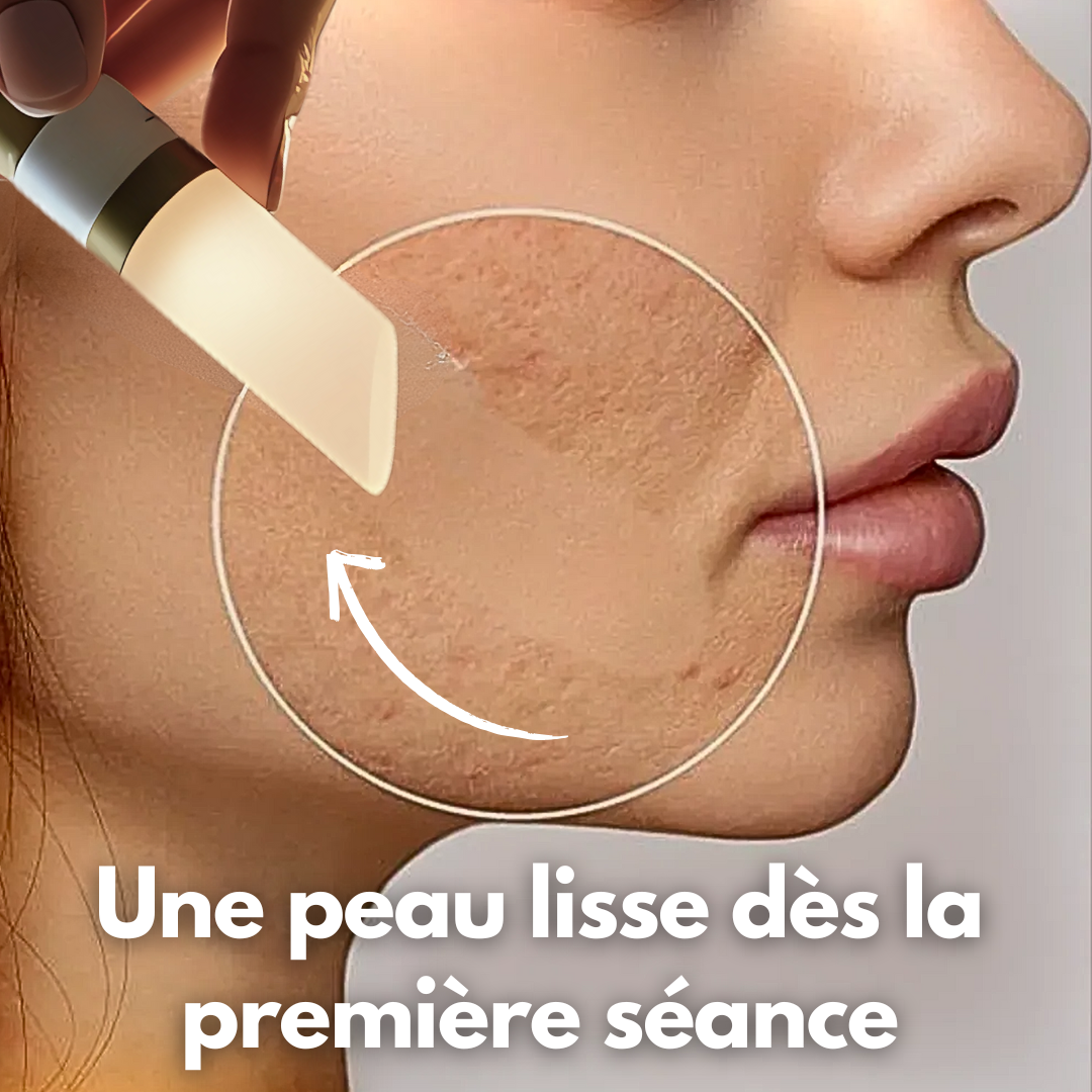 Le Diamondstick® - Le Peeling nouvelle génération