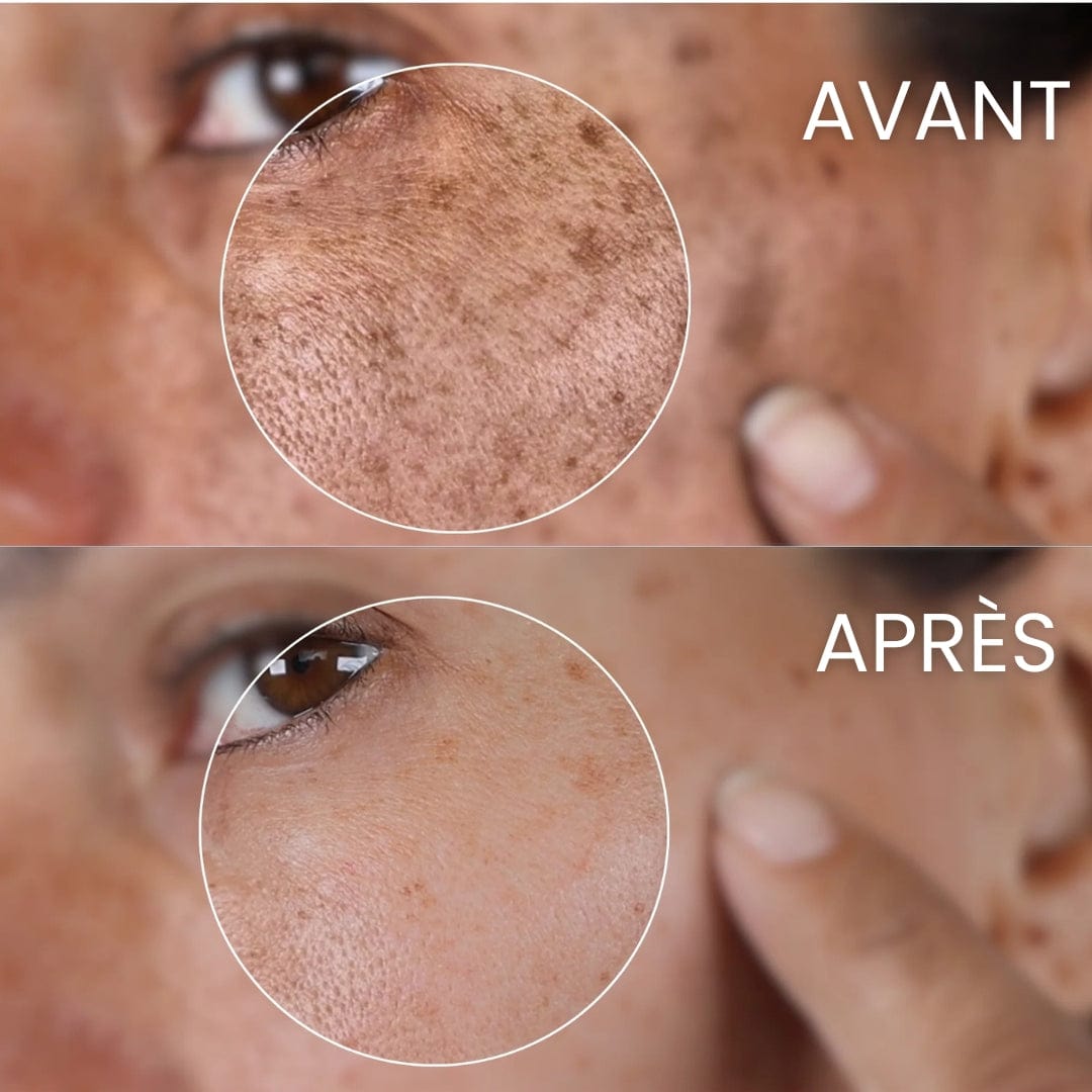 Le Diamondstick® - Le Peeling nouvelle génération